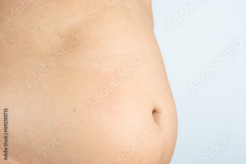 male showing of an overweight belly