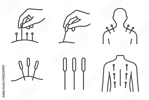 Acupuncture illustration set with needles on human body and hands