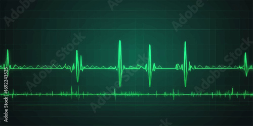 Medical monitor showing a green cardiogram heartbeat line and pulse rate graph