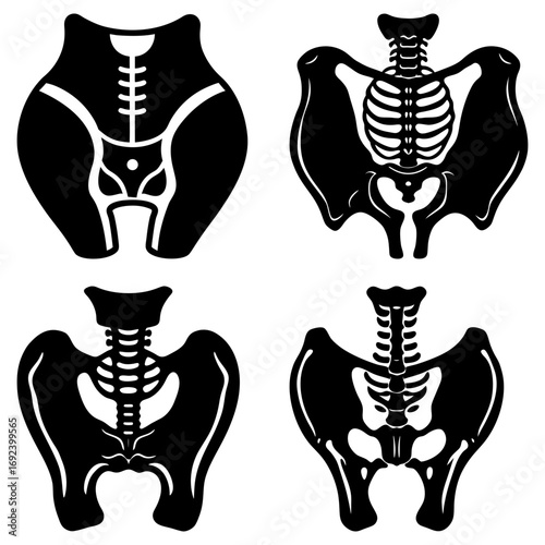 Illustration showcasing four variations of pelvic bone and spine anatomy in a stylized black and white design