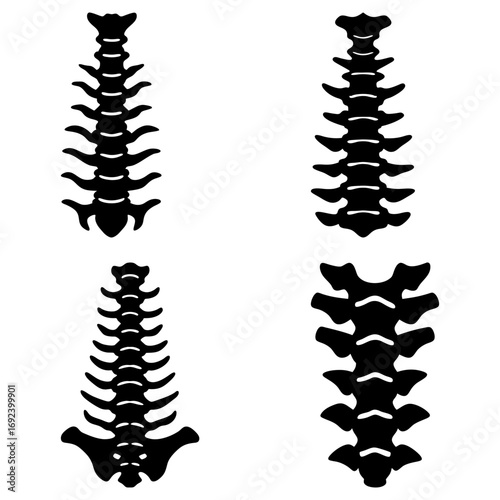 Four black and white anatomical illustrations of spinal columns with varying bone structures displayed