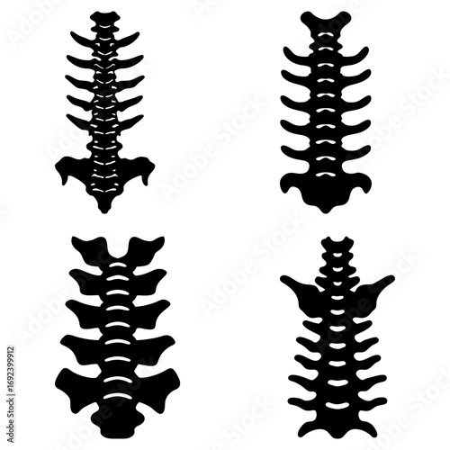 Four anatomical spine illustrations showing different spinal structures in black silhouette form on a white background