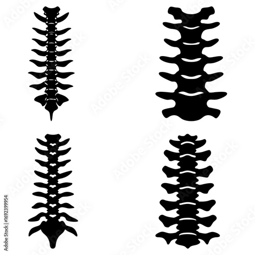 Four anatomical spine illustrations showing the vertebral column in black silhouette on a white background