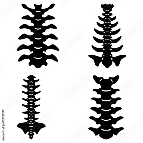 Four black and white spine illustrations showing different spinal column configurations and bone structures