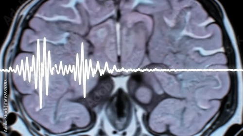 Animated MRI scan with live EEG waveform glowing over brain cross-section, pulsing and calming as ambient light flickers