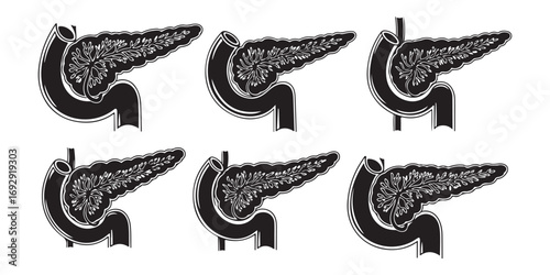This image displays six distinct, artistic renderings of the human pancreas, presented in a monochrome, textured style against a white background.