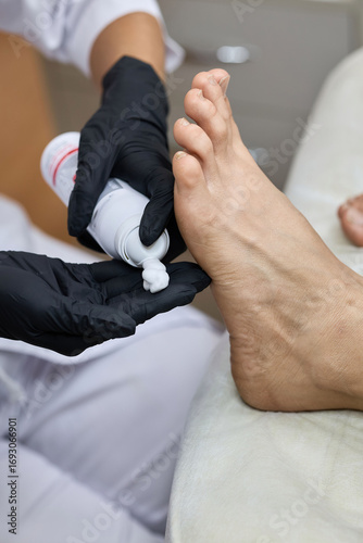 Foot care treatment with moisturizing cream