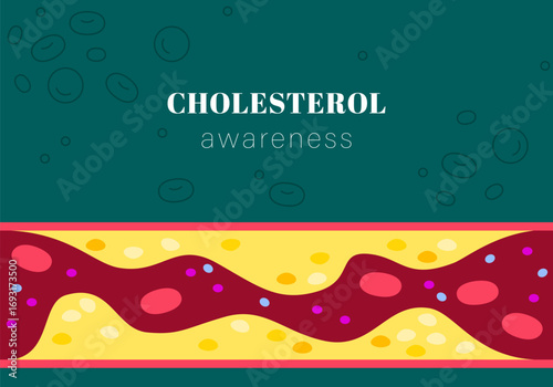 Cholesterol. Artery blocked with cholesterol, blood pressure, arteriosclerosis