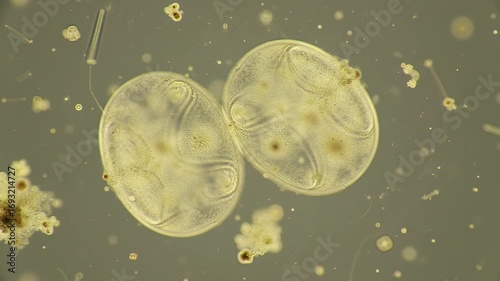 Close Up View of Two Ascaris Lumbricoides Parasitic Worms Under Microscope on Light Background Detailed Biological Study of Helminth Intestinal Infections Educational Illustration 190 Char