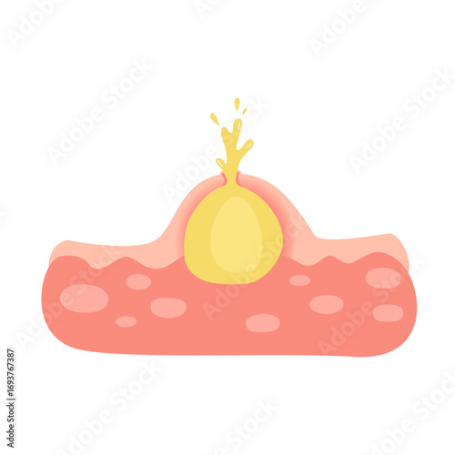 Acne facial type concept. vector illustration