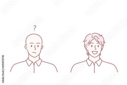 Hair loss and baldness concept. Faces of young completely bald man with frustrated mood and happy smiling hairy person vector illustration
