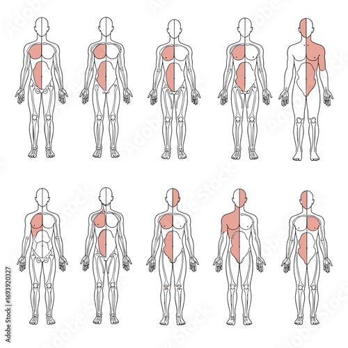 Understanding referred pain patterns in the human body illustrating various somatic zones