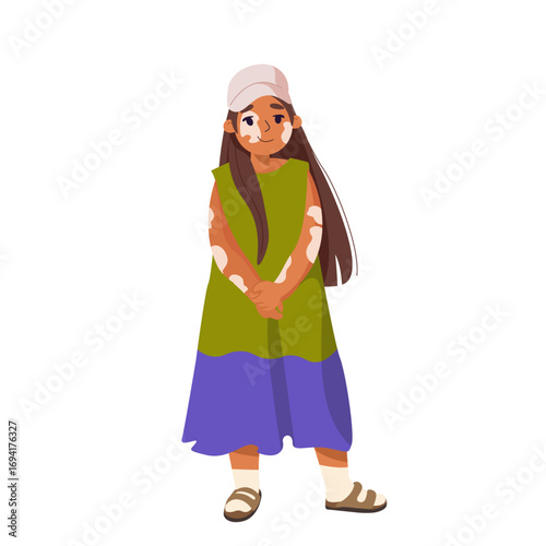 Positive cute small girl with vitiligo disease. Child with skin pigmentation problems. Skin diseases. Concepts of love yourself, dermatological illness. Cartoon vector illustration isolated on white