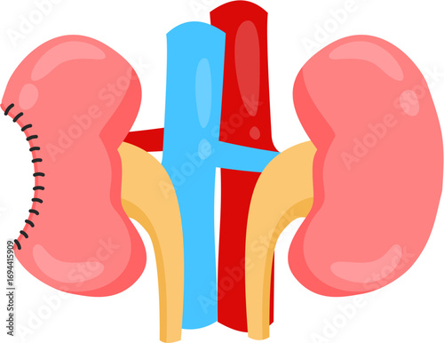 Partial Nephrectomy