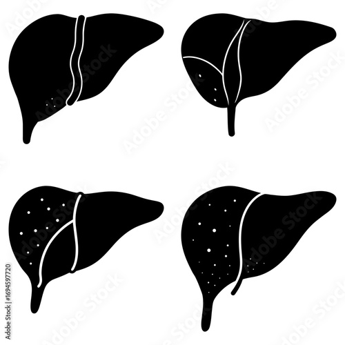 Four liver illustrations showcasing different stages or conditions of the organ in black and white style