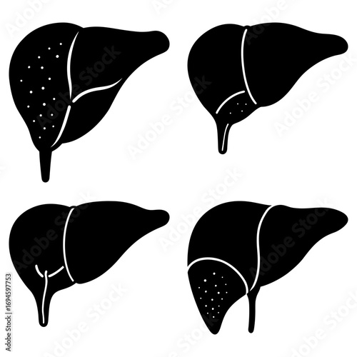 Four liver illustrations showing different stages or types of liver disease in a simple black and white style
