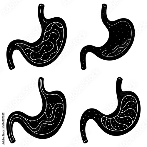 Four black and white stomach illustrations showing different levels of fullness and digestion stages present