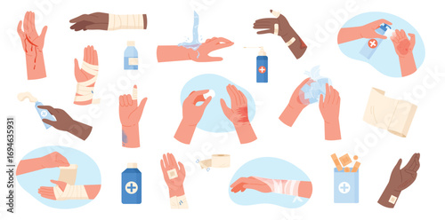 Injured hands set vector illustration. Cartoon isolated human arms with wounds and burn on body skin, cleaning and dressing with bandages, applying medical treatment for injury, first aid for trauma