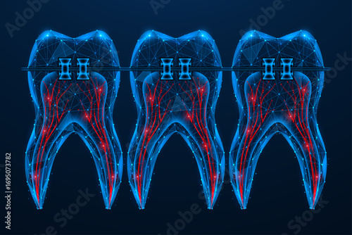 Three teeth connected by braces. Teeth with visible nerves and root canals. Polygonal design of interconnected lines and dots. Blue background.