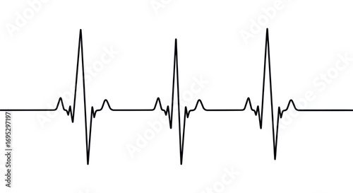 Black and White Heartbeat Line Graphic Illustration of a Normal Rhythm Visualization