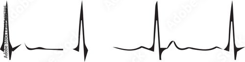 Black heartbeat line without background
