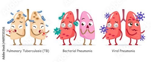 Set of lung infection disease cartoon characters . Including pulmonary tuberculosis, bacterial pneumonia and viral pneumonia . Isolated on white background . Vector .