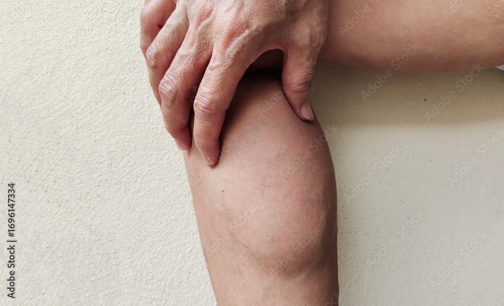 Naklejka premium portrait the leg calf muscle, bulging and calves, muscular and varicose veins on the body, health care and beauty concept.