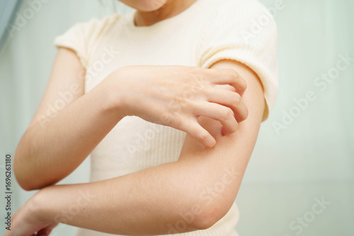 Asian woman itching of skin diseases using hand scratching.