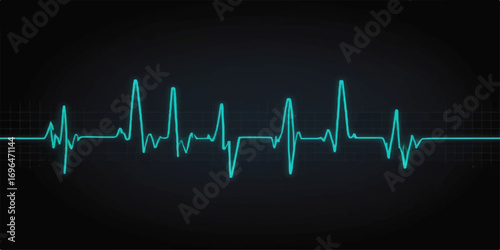 A graphic representation of a heart's electrical activity shown as a green pulse line on a medical monitor