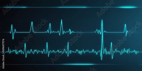 A pulsating green cardiogram line graphs a human heartbeat on a medical monitor