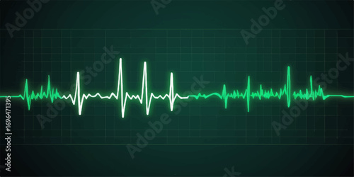 A cardiogram shows the green heartbeat pulse line on a medical monitor