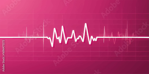 Blue medical cardiogram graph shows a steady heartbeat on a hospital monitor, illustrating a healthy pulse and normal EKG test results