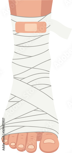 Medical Illustration of Human Foot with Bandage and Plaster for Injury Care and Rehabilitation