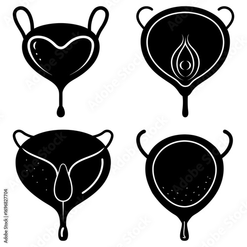 Anatomical illustrations depicting different bladder shapes and conditions in black and white graphic style