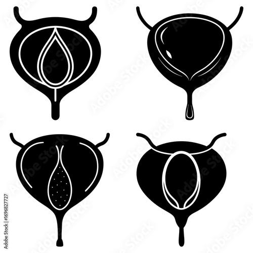 Anatomical illustration showing bladder variations with different shapes and internal structures depicted in black
