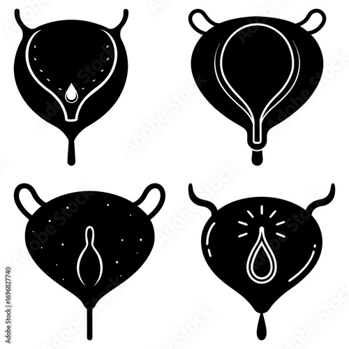 Four bladder illustrations showing different stages of fullness and fluid retention in black and white style