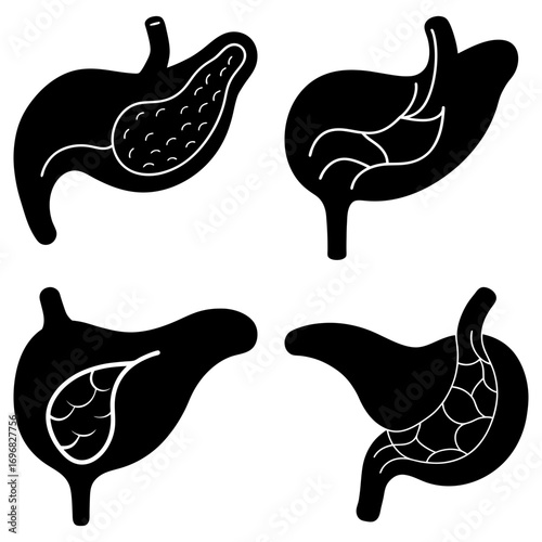 Four black and white anatomical drawings of stomachs with internal structures shown in different views