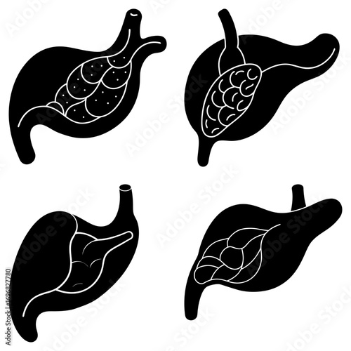 Illustration depicting human stomach and liver anatomy with internal structures shown in black and white