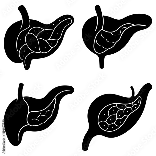 Four pancreas illustrations showing different internal structures in black and white color scheme