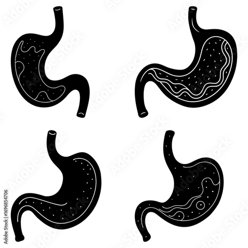 Four black and white stomach illustrations showing different internal structures and conditions of the organ
