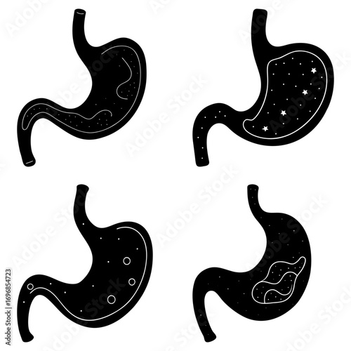 Four stomach illustrations showing different conditions and internal compositions in black and white style
