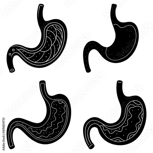 Four stomach illustrations showing different internal states in black and white anatomical drawing style