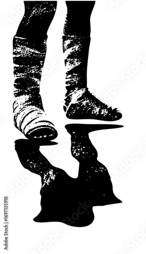Vector Injured legs with casts stand on a balance beam.