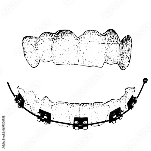 Vector Dental braces and teeth showcases orthodontic treatment.