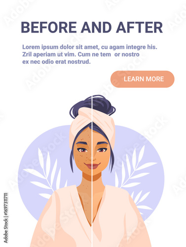 Before and after skincare treatment woman face split comparison healthy glowing skin towel headband robe botanical background pastel colors