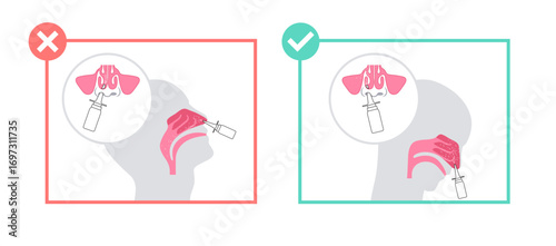 Proper nasal spray usage