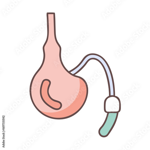 Illustration of a male reproductive system with medical device