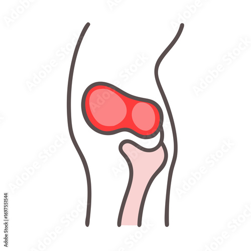 Knee joint anatomy with inflammation graphic illustration in vector