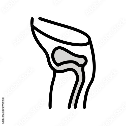 Medical illustration of the oropharynx area with tonsil in light gray