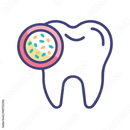 Tooth decay illustration highlighting bacterial plaque on a molar